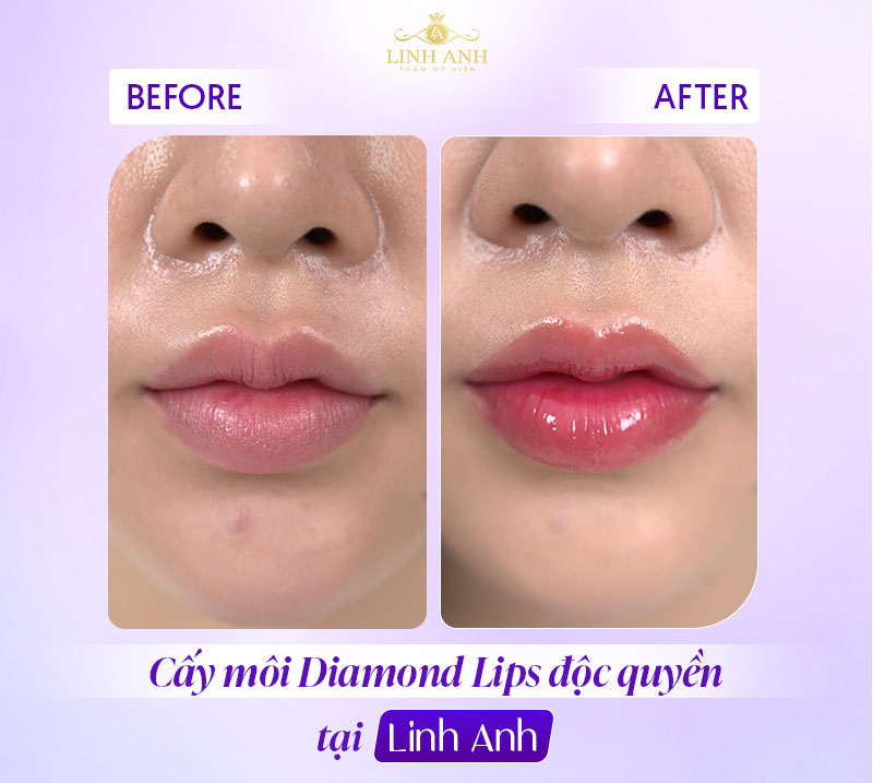 xăm môi xong bị khô xăm môi xong bị khô