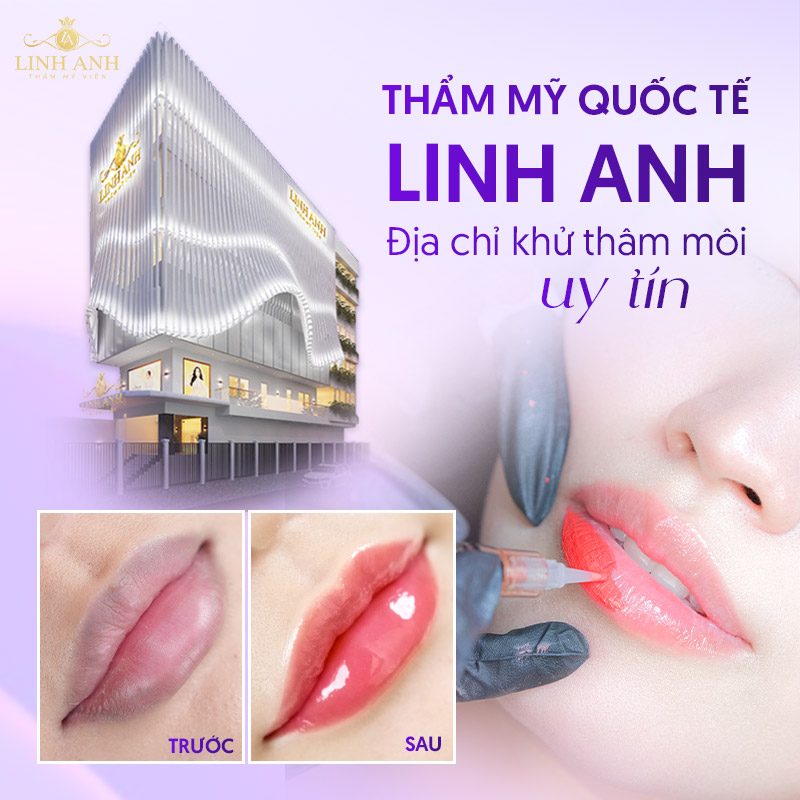 xóa thâm môi xong có thâm trở lại không