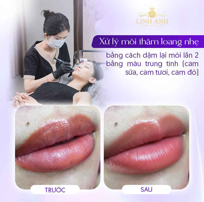 cách khắc phục môi bị thâm loang sau xăm cách khắc phục môi bị thâm loang sau xăm