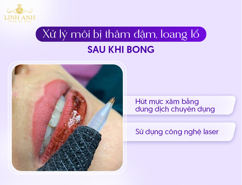 cách phòng ngừa môi bị thâm loang sau khi bong cách phòng ngừa môi bị thâm loang sau khi bong
