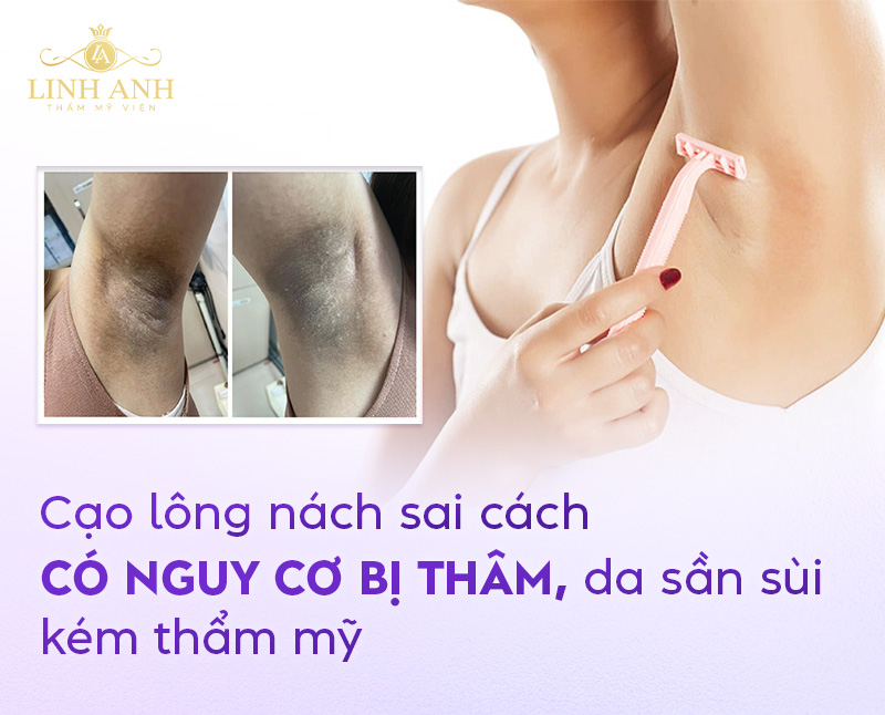 cạo lông nách có ảnh hưởng gì không cạo lông nách có ảnh hưởng gì không