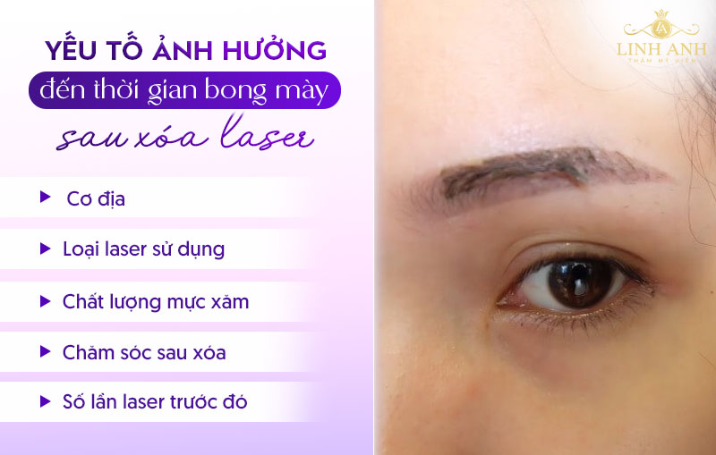 chân mày sau bao lâu thì bong sau xóa xăm chân mày sau bao lâu thì bong sau xóa xăm