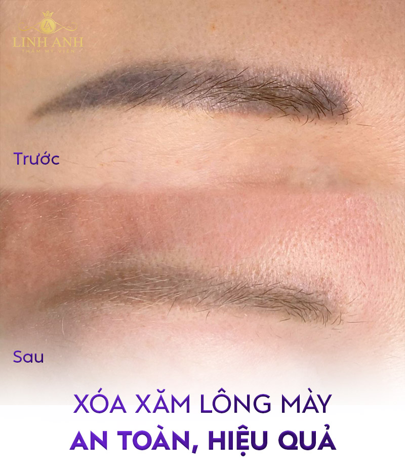 chân mày sau xăm bao lâu thì sửa lại được chân mày sau xăm bao lâu thì sửa lại được