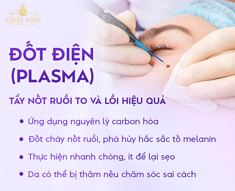 Đốt điện nốt ruồi to và lồi