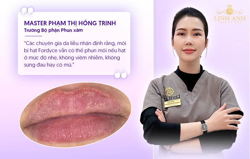 môi bị hạt Fordyce vẫn có thể phun môi được