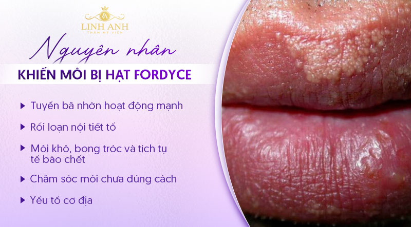 môi bị hạt fordyce có xăm được không