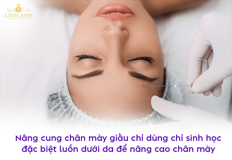nâng cung chân mày giấu chỉ là gì nâng cung chân mày giấu chỉ là gì