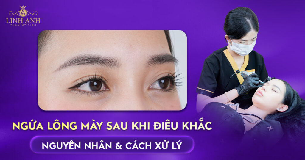 ngứa lông mày sau khi điêu khắc