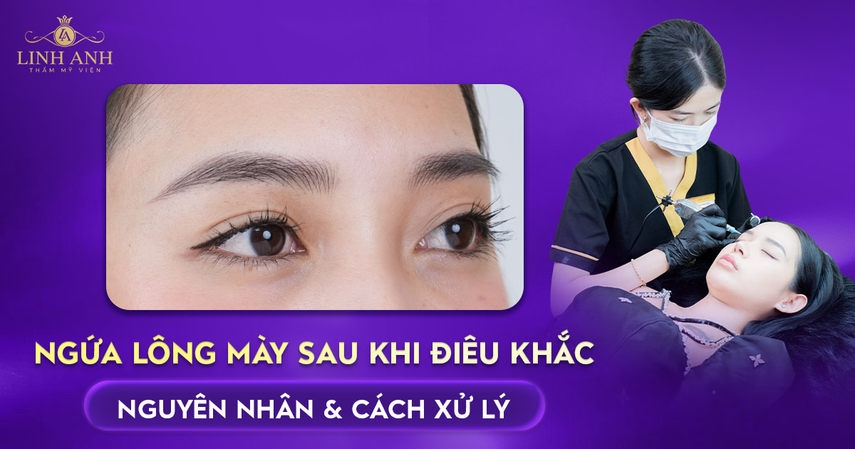 Ngứa lông mày sau khi điêu khắc: Nguyên nhân và cách xử lý