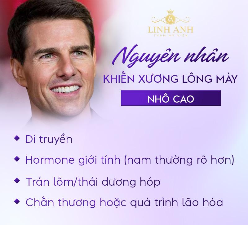 nguyên nhân khiến xương lông Mày nhô cao nguyên nhân khiến xương lông Mày nhô cao