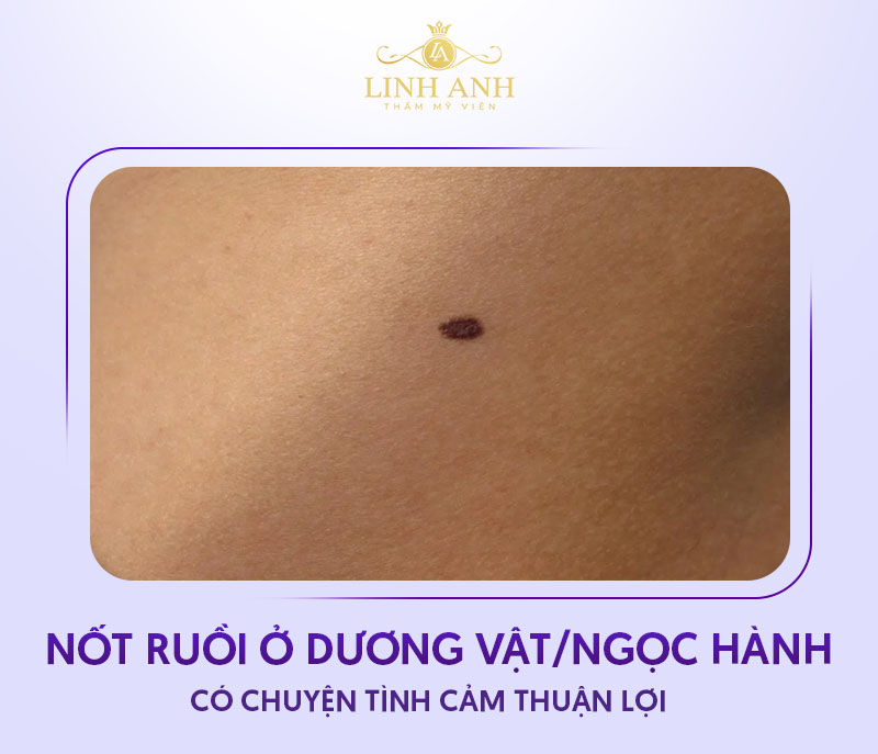 Nốt ruồi ở vùng kín nam giới Nốt ruồi ở vùng kín nam giới