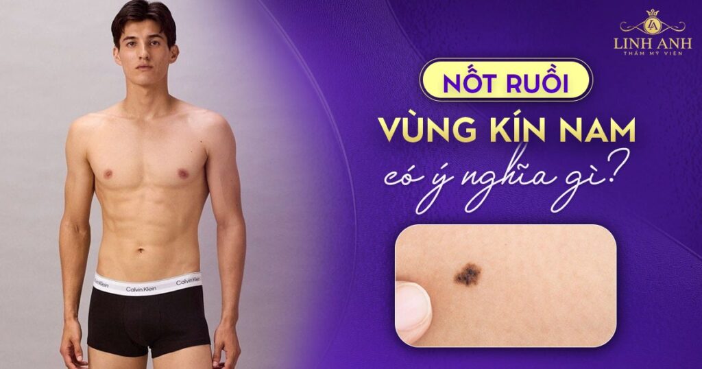Nốt ruồi vùng kín nam