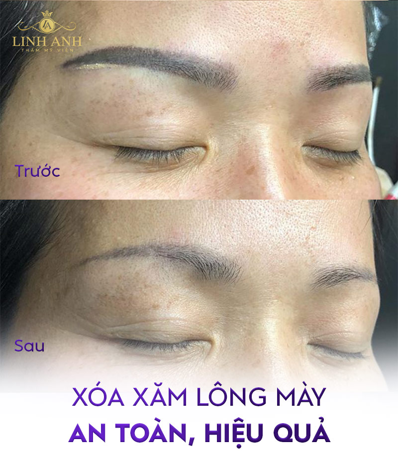 phun chân mày bao lâu thì sửa lại được phun chân mày bao lâu thì sửa lại được