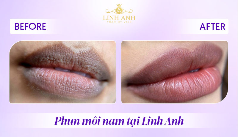 phun xăm môi cho nam giới phun xăm môi cho nam giới