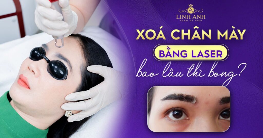 xoá chân mày bằng laser bao lâu thì bong