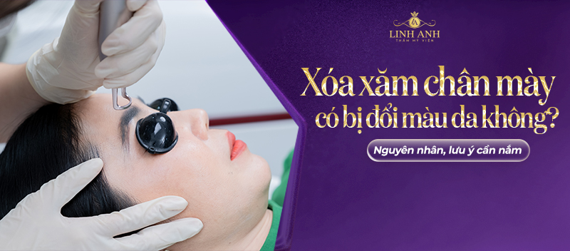 xóa xăm chân mày có bị đổi màu da không