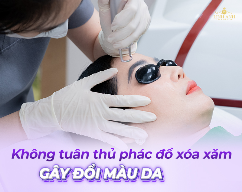 xóa xăm chân mày có gây đổi màu da không xóa xăm chân mày có gây đổi màu da không