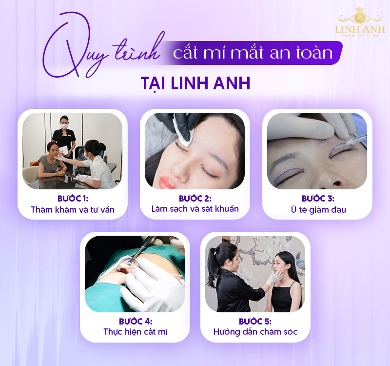 ảnh khách hàng cắt mí mắt 1 tháng ảnh khách hàng cắt mí mắt 1 tháng