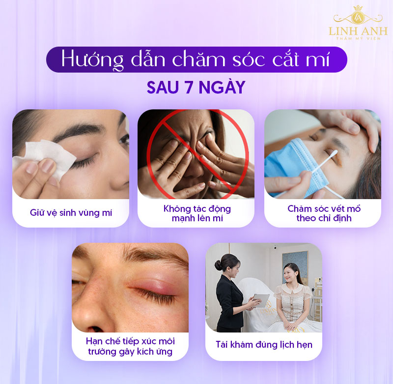 ảnh thực tế cắt mí sau khoảng 7 ngày ảnh thực tế cắt mí sau khoảng 7 ngày