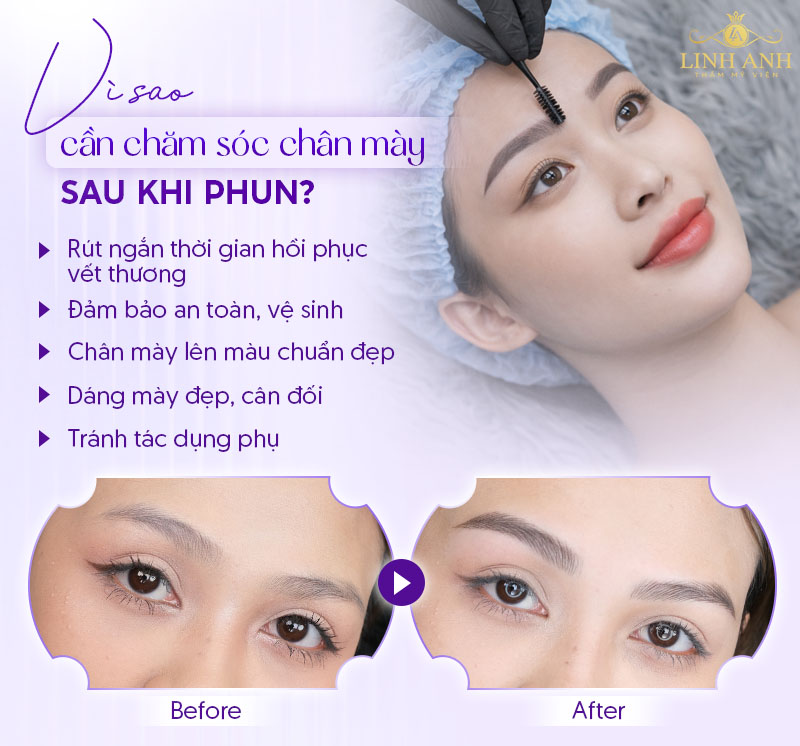 cách chăm sóc chân mày sau khi bong vảy cách chăm sóc chân mày sau khi bong vảy