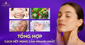 Cách hết nọng cằm nhanh nhất