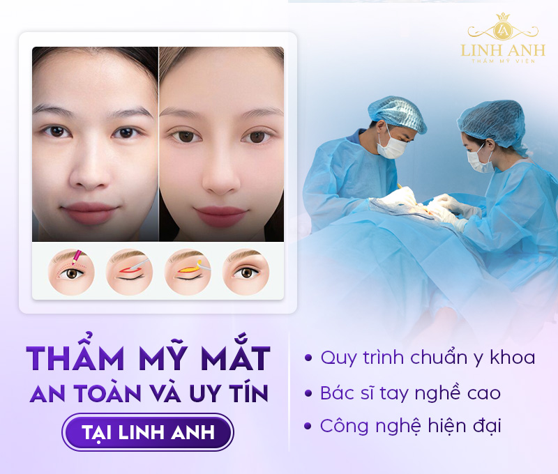 đặc điểm mắt cười đặc điểm mắt cười