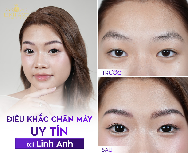 điêu khắc chân mày có ưu nhược điểm gì điêu khắc chân mày có ưu nhược điểm gì