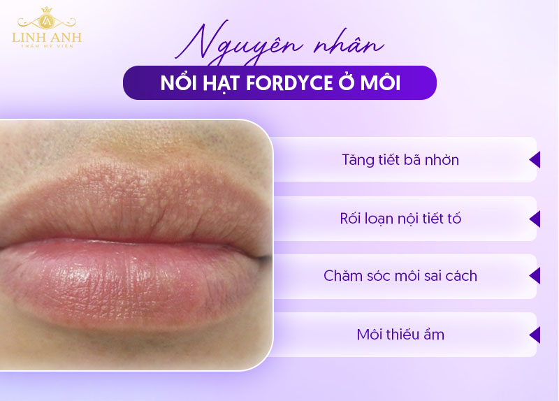 Hạt fordyce ở môi nguyên nhân Hạt fordyce ở môi nguyên nhân