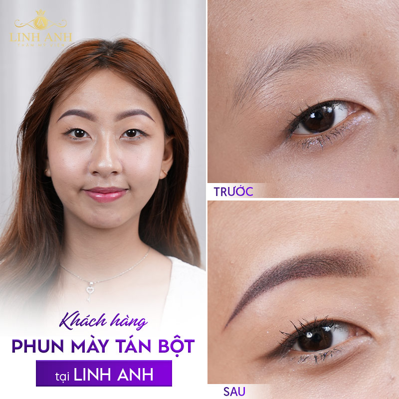 Khách hàng phun mày tán bột tại Linh Anh