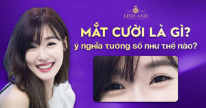mắt cười