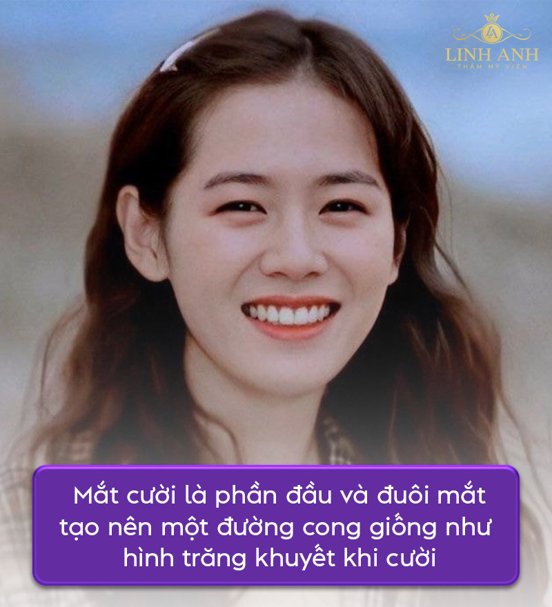 mắt cười là gì mắt cười là gì