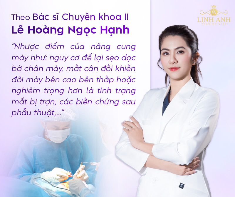 nhược điểm của nâng cung chân mày nhược điểm của nâng cung chân mày