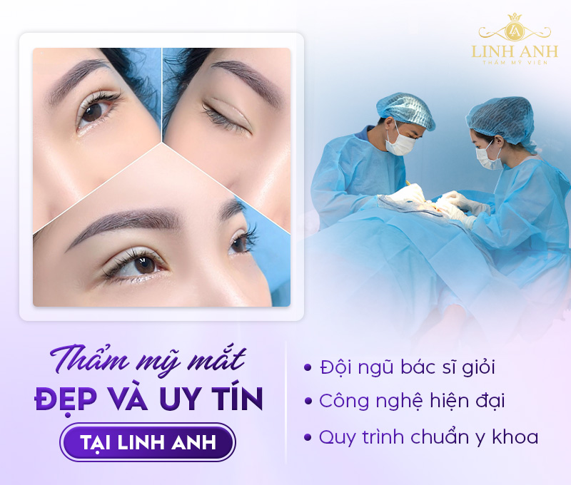 thẩm mỹ mắt hạnh nhân thẩm mỹ mắt hạnh nhân
