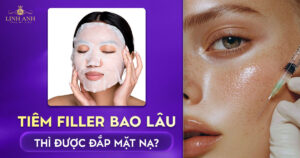 Tiêm filler bao lâu thì được đắp mặt nạ