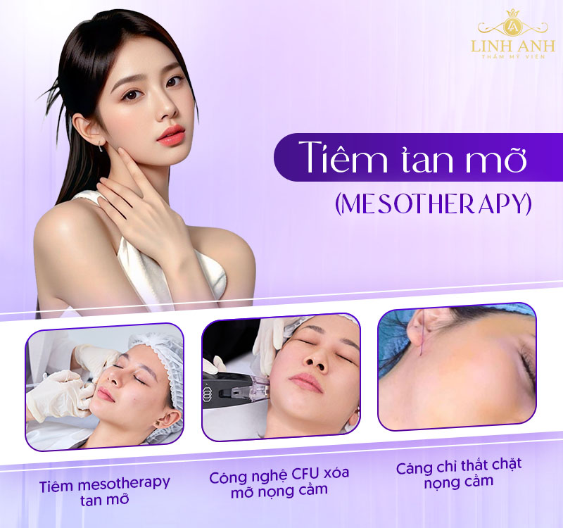 Tiêm tan mỡ nọng cằm