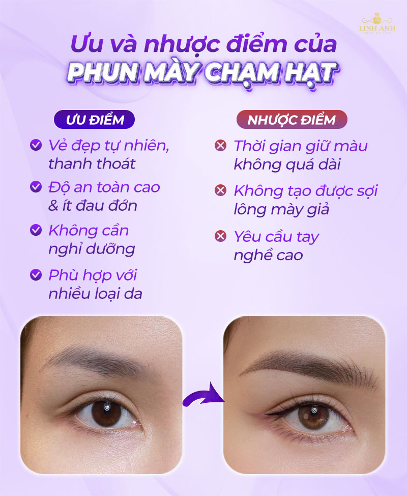 ưu điểm của Phun mày chạm hạt ưu điểm của Phun mày chạm hạt