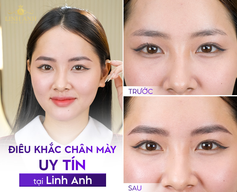 ưu nhược điểm của điêu khắc chân mày ưu nhược điểm của điêu khắc chân mày