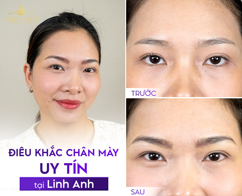 ưu nhược điểm của điêu khắc mày ưu nhược điểm của điêu khắc mày