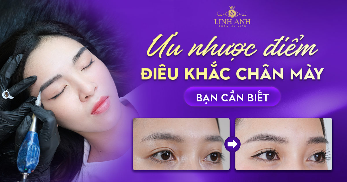 [Giải đáp] Ưu nhược điểm điêu khắc chân mày bạn cần biết