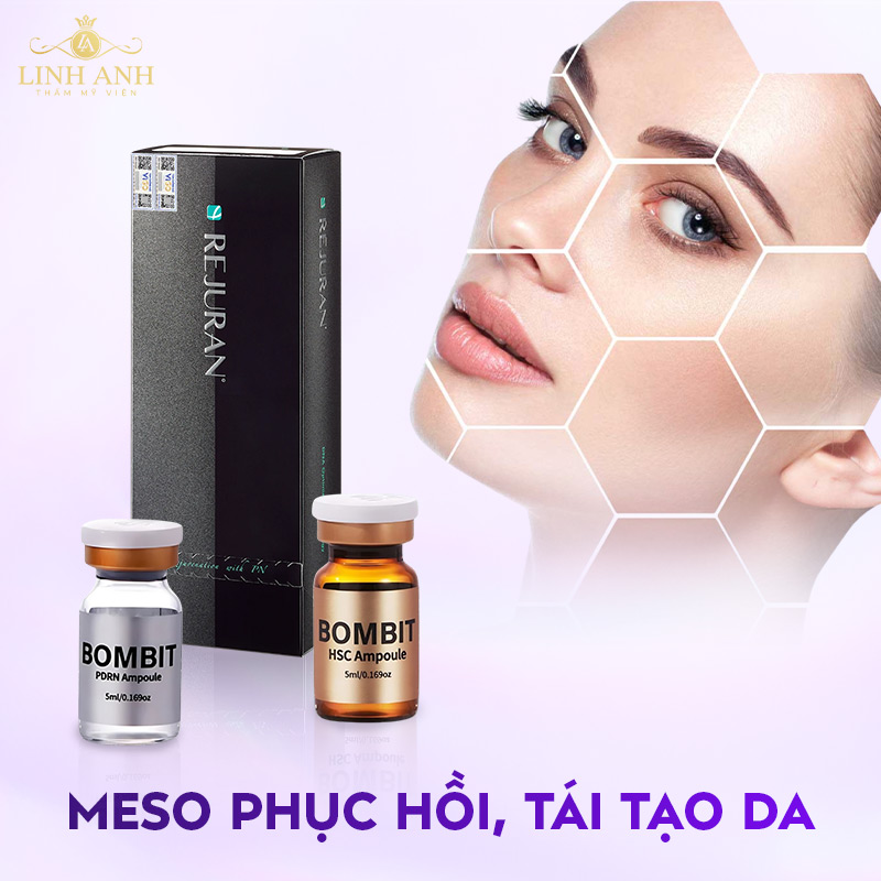 Top các sản phẩm Meso bán chạy Top các sản phẩm Meso bán chạy