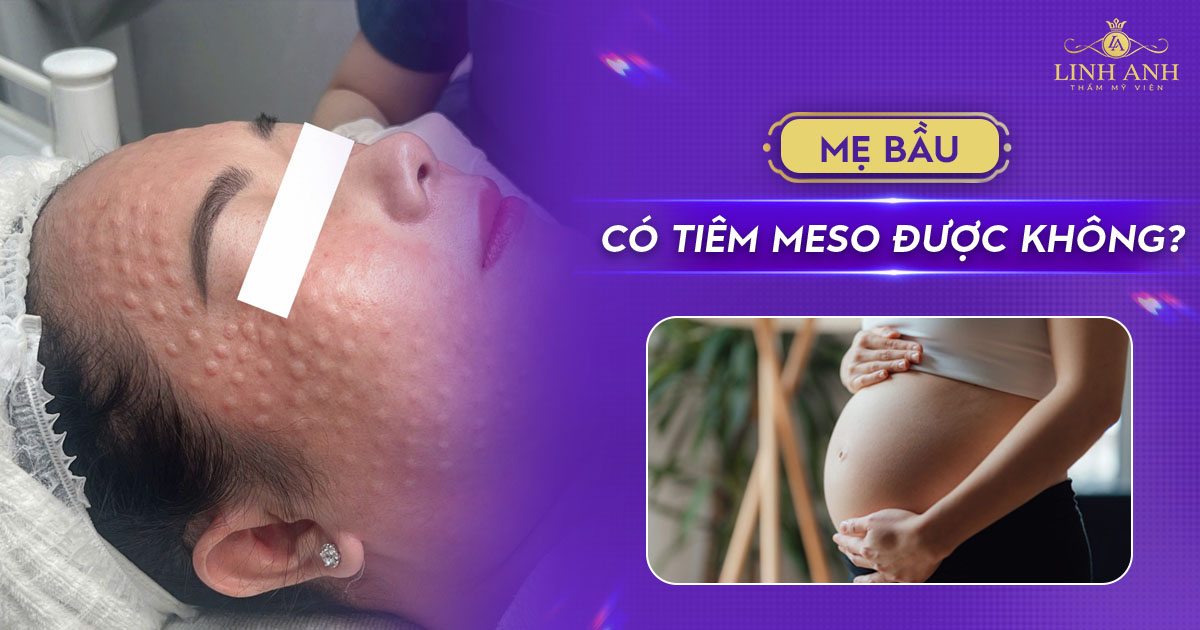Mẹ bầu có tiêm meso được không? Bác sĩ giải đáp chi tiết