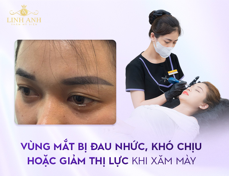 biến chứng khi xăm chân mày biến chứng khi xăm chân mày