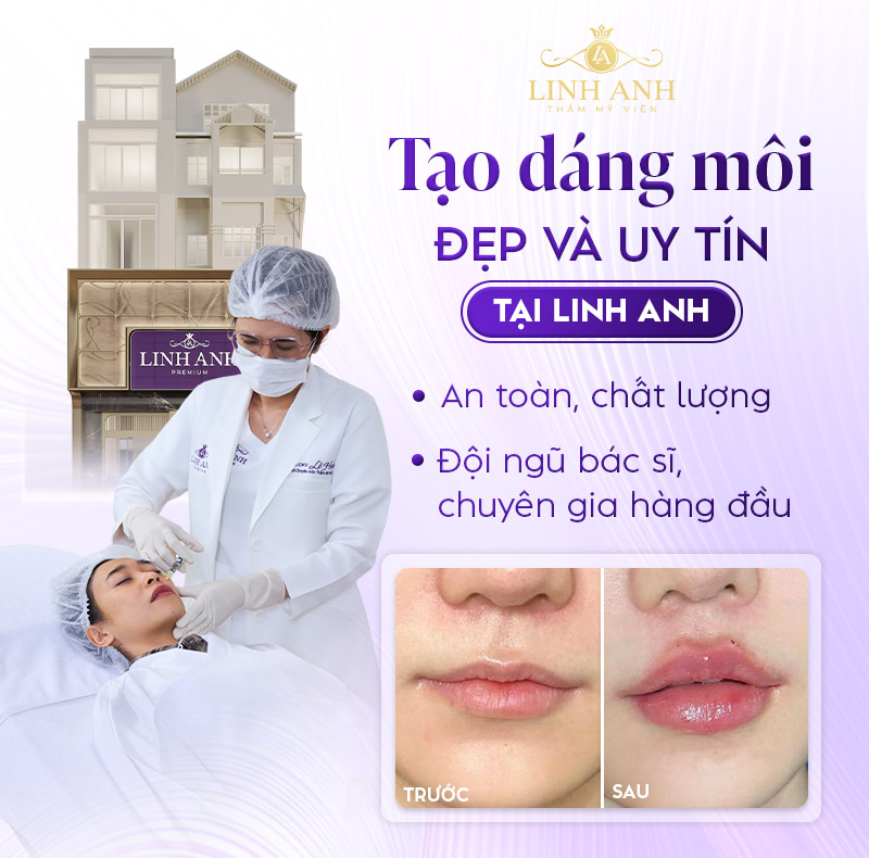 các dáng môi cánh hoa các dáng môi cánh hoa