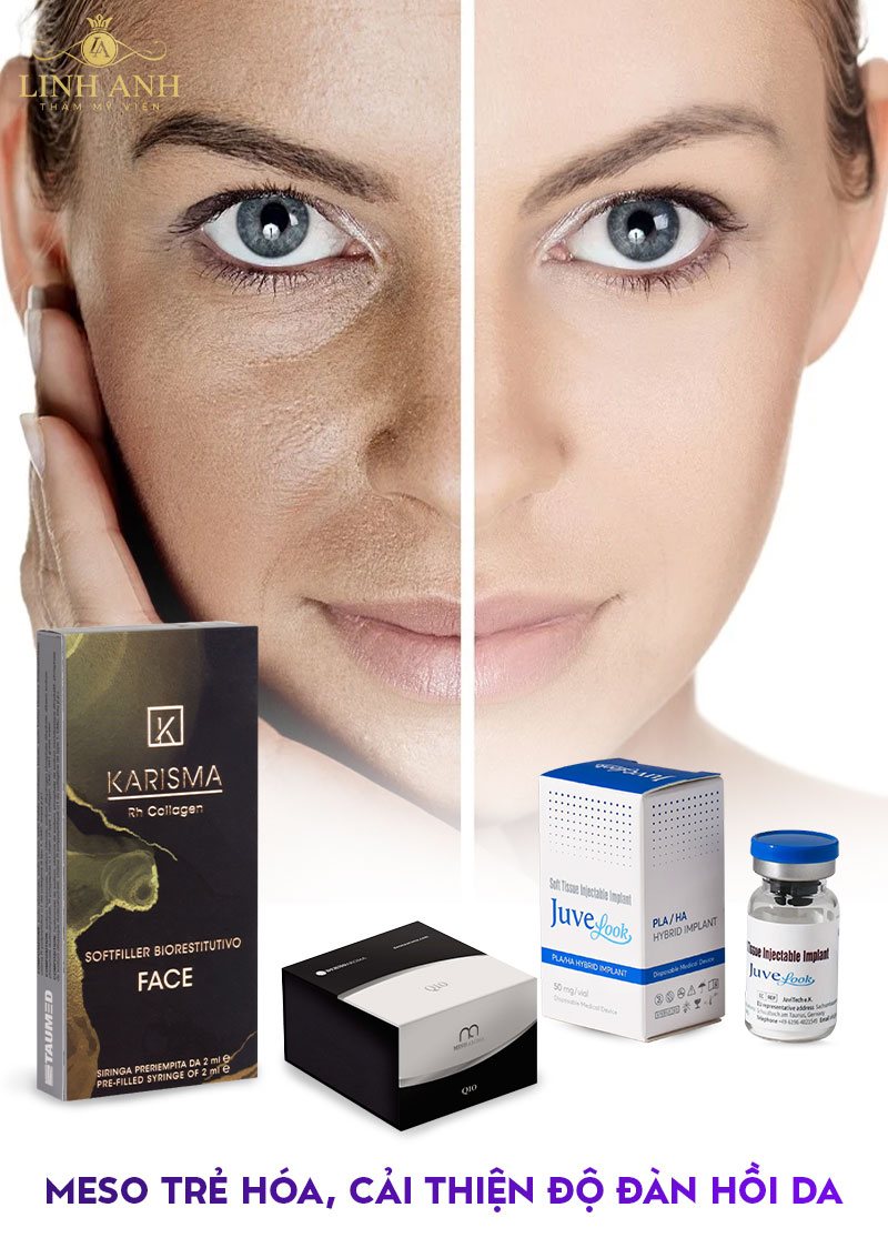 các loại meso tốt nhất các loại meso tốt nhất