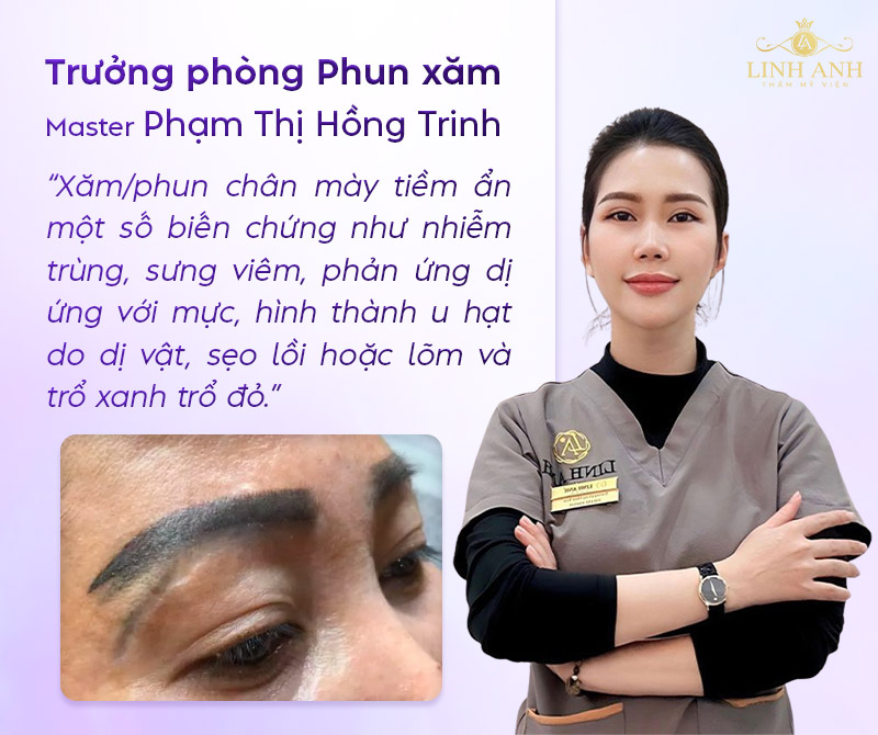 làm chân mày có hại gì về sau không làm chân mày có hại gì về sau không