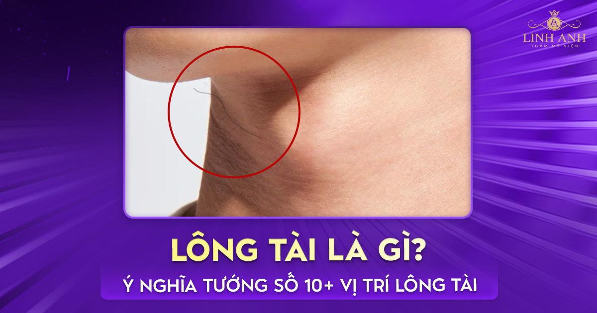 Lông tài là gì? Ý nghĩa tướng số 10+ vị trí lông tài phổ biến nhất