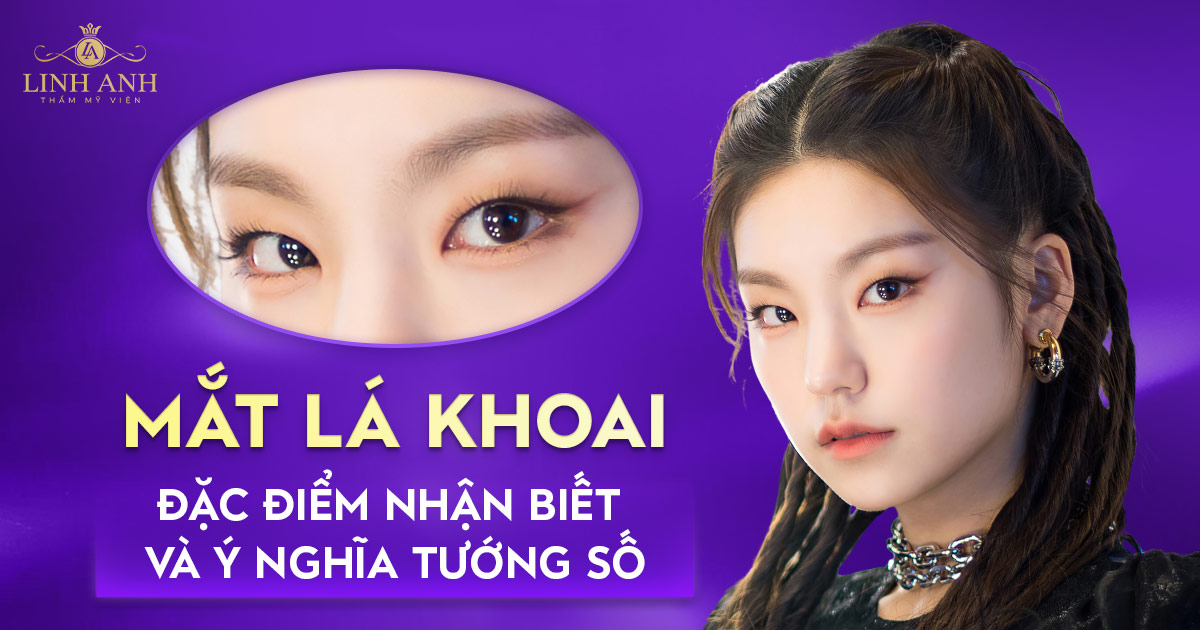 mắt lá khoai