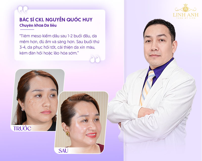 meso exocode giá bao nhiêu meso exocode giá bao nhiêu