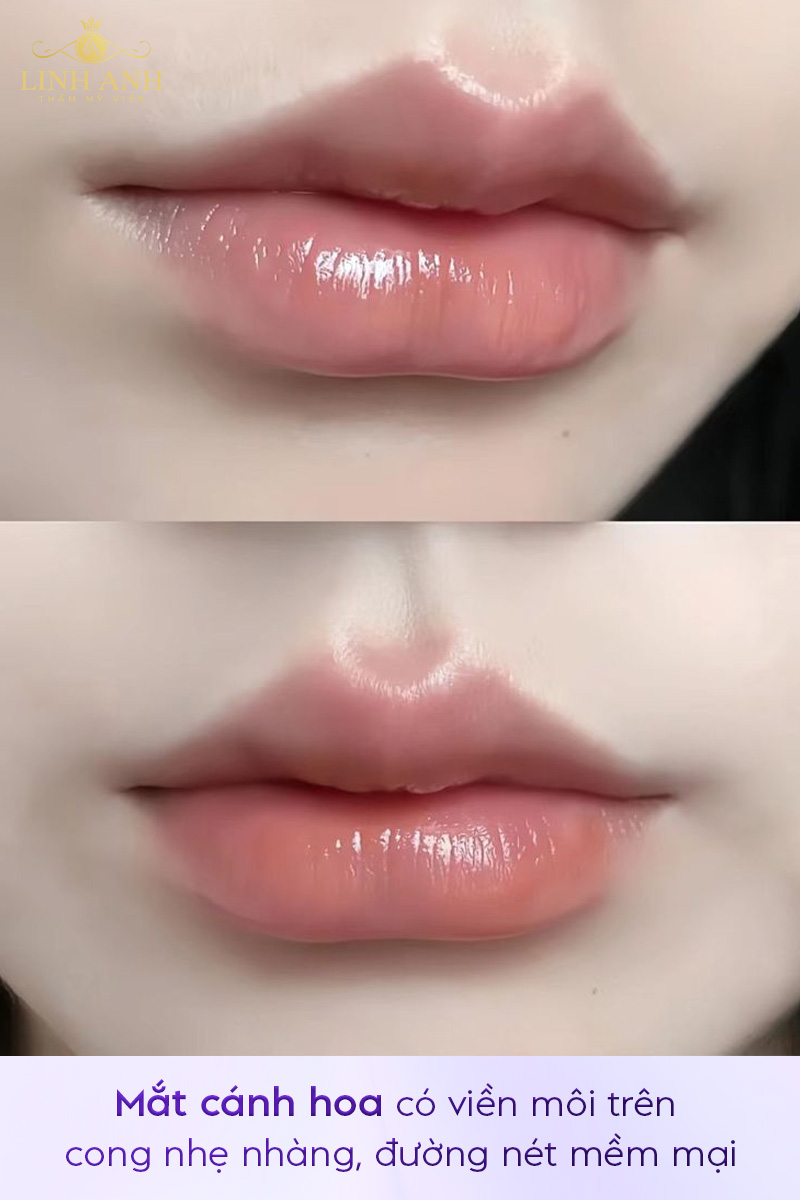 môi cánh hoa là gì môi cánh hoa là gì