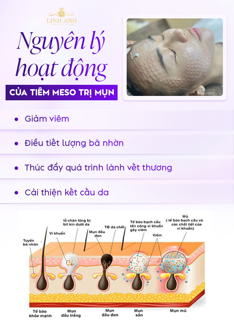 Nguyên lý hoạt động Meso mụn Nguyên lý hoạt động Meso mụn